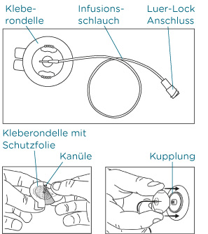 Bestandteile eines Infussionssets Bestandteile eines Infussionssets